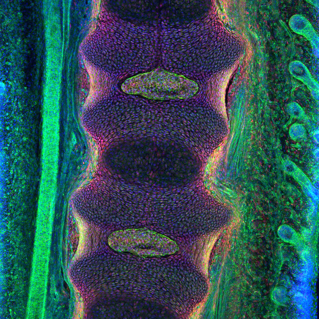 Spatial and temporal regulation of Collagen 2 labeling in the developing intervertebral disk